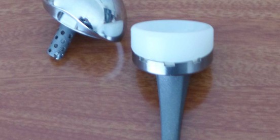 Pathologie de la coiffe des rotateurs et arthrose de l&rsquo;épaule