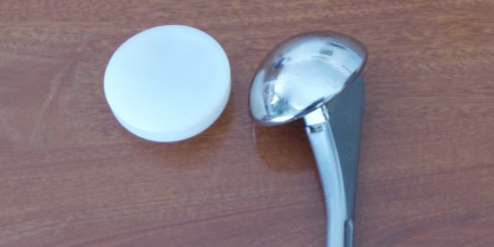Pathologie de la coiffe des rotateurs et arthrose de l&rsquo;épaule