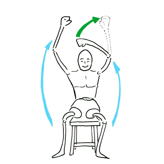 Fig.2: PTE sans restauration de la rotation externe, le coude monte sans la main 
